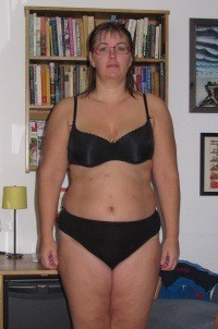 gastric bypass blog, before after pictures