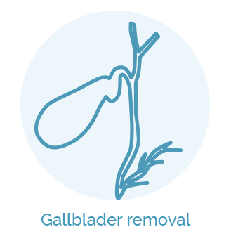 Gallblader Removal