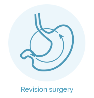 Revision surgery